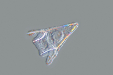 Oursin - Larve Pluteus d'Oursin jeune x60